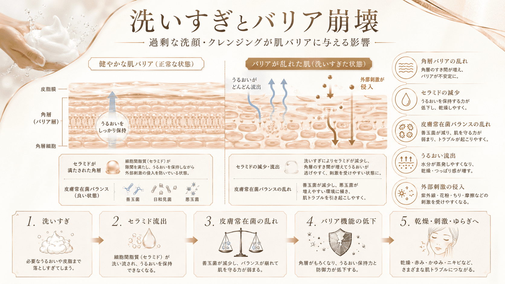 過剰な洗顔とクレンジングによって角層バリア、セラミド、皮膚常在菌が乱れる仕組みを示した上品な図解